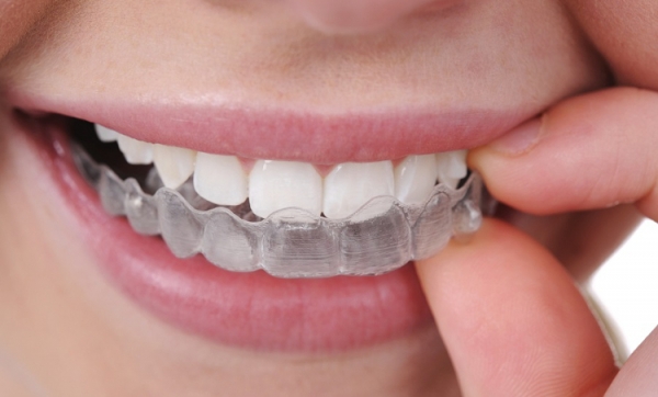 Leczenie ortodontyczne a dieta ?