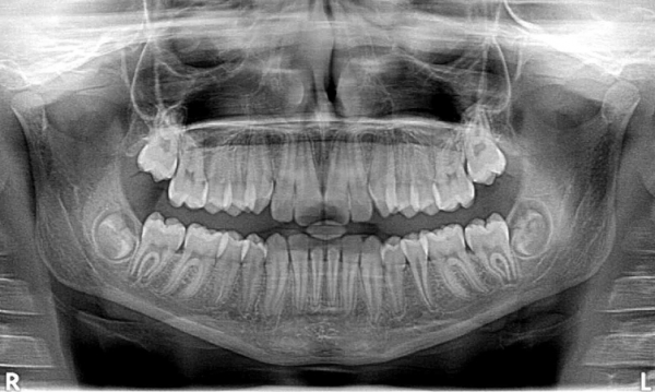 Tomografia stomatologiczna – czym jest i na czym polega