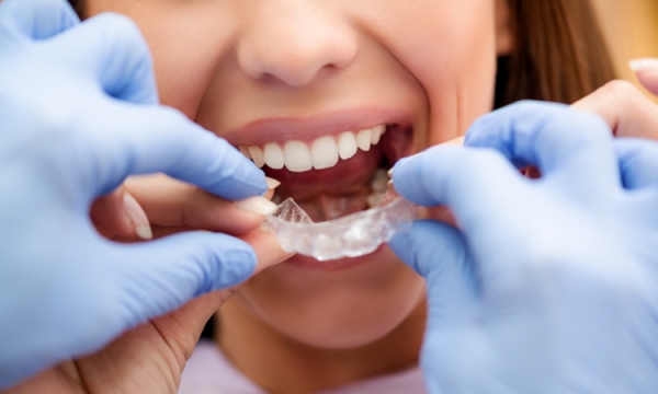 Na czym polega leczenie ortodontyczne aparatami zdejmowanymi?